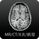 趙寅成圖片
